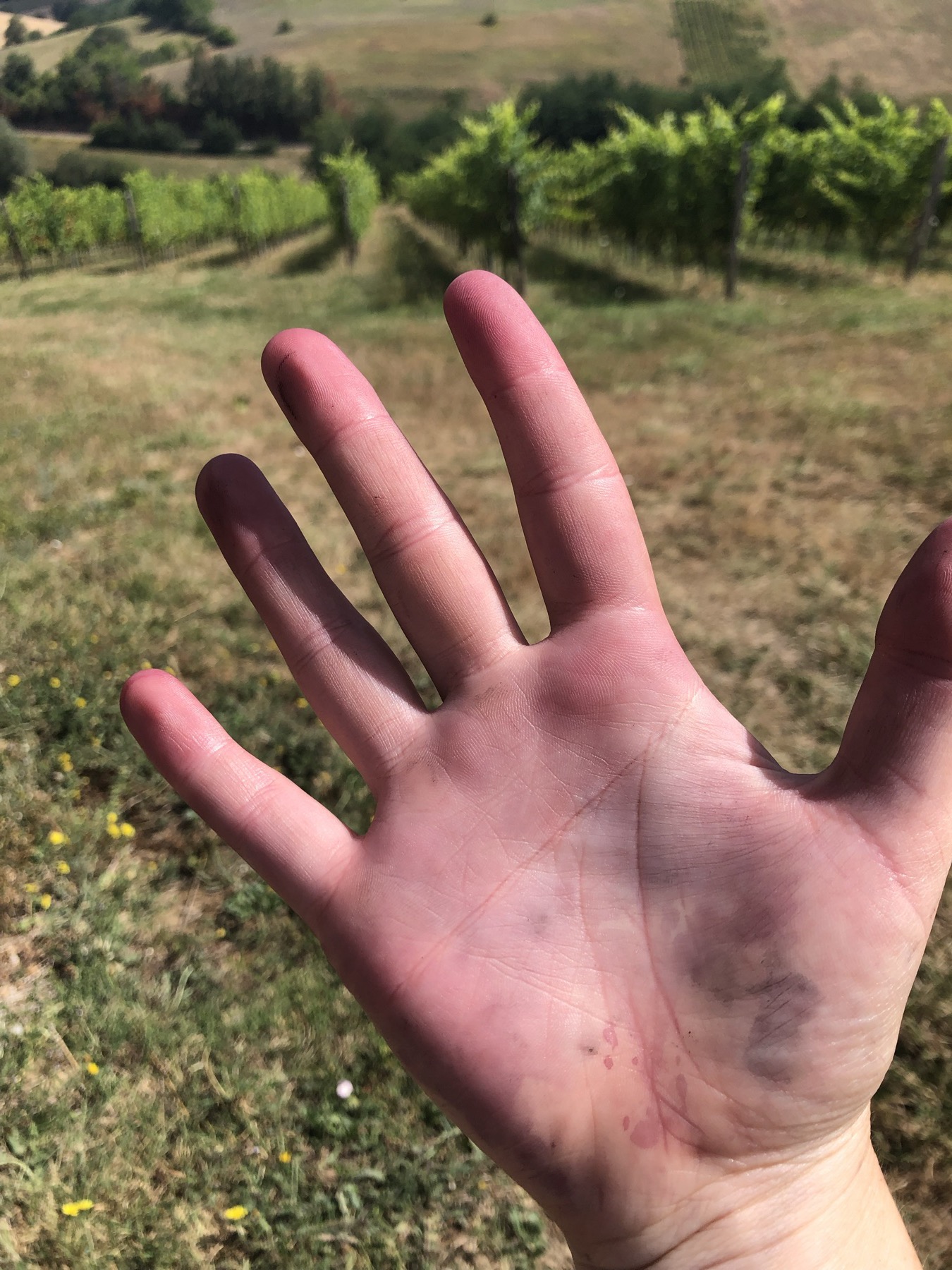 A palm stained purple with grape juice